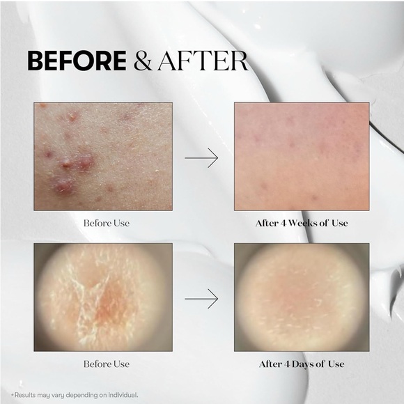 VT Cosmetics CICA Reedle Shot 700 - Picture 5 of 6